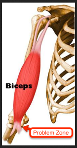 bicipital-tendonitis wod